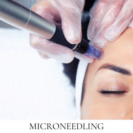 1 Microneedling Skin Care Service